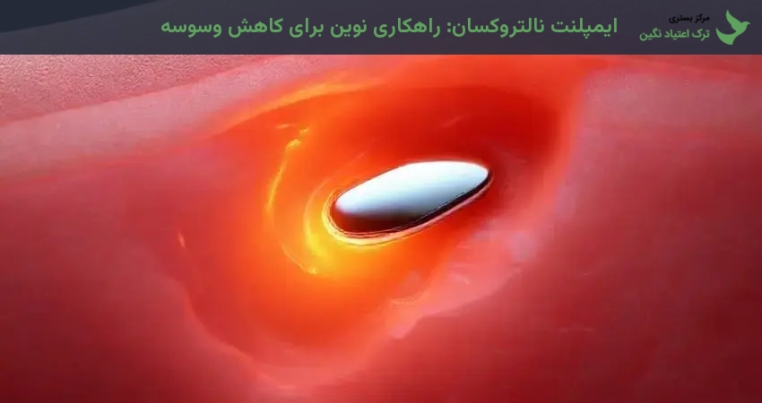 ایمپلنت نالتروکسان: راهکاری نوین برای کاهش وسوسه