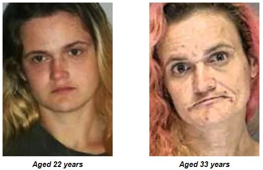 قبل و بعد از اعتیاد به هروئین