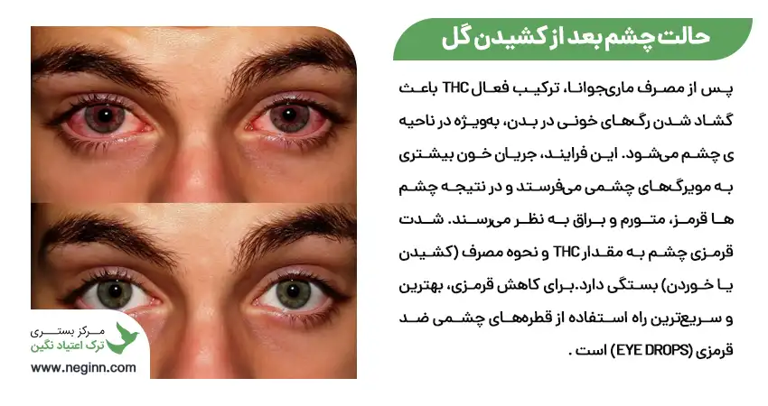 حالت چشم بعد از کشیدن گل