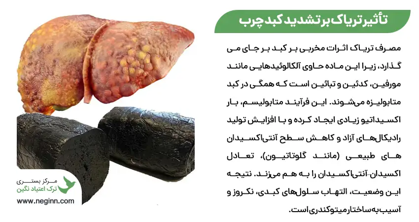 تأثیر و مضرات مصرف تریاک برای کبد چرب