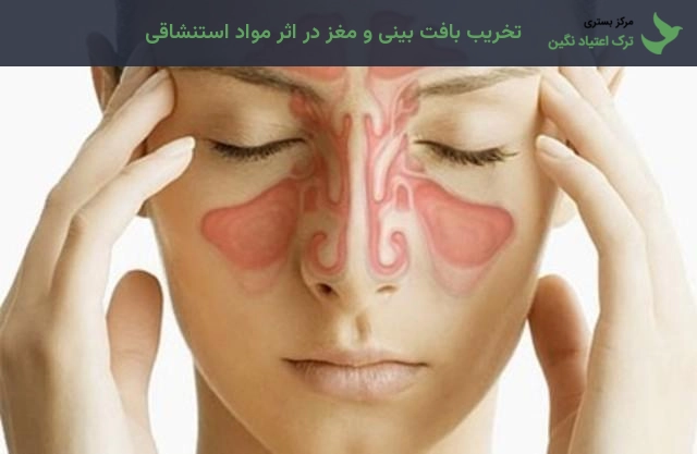 تخریب بافت بینی و مغز در اثر مواد استنشاقی