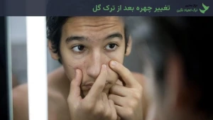 تغییر چهره بعد از ترک گل