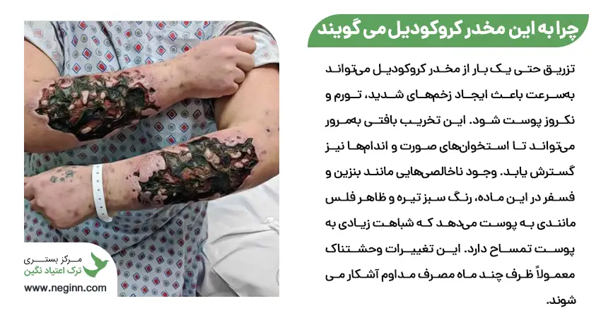 چرا به این ماده ی مخدر کروکودیل می گویند؟