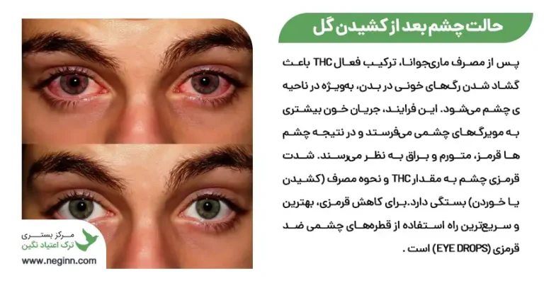 حالت چشم بعد از کشیدن گل